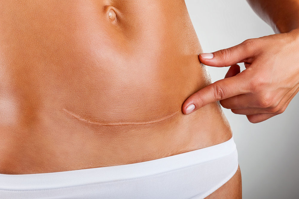A Comprehensive Guide on Signs and Diagnosis of Ovarian Cancer