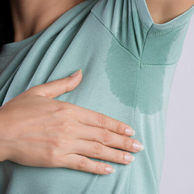 Diagnosis Methods and Treatment Options for Hyperhidrosis