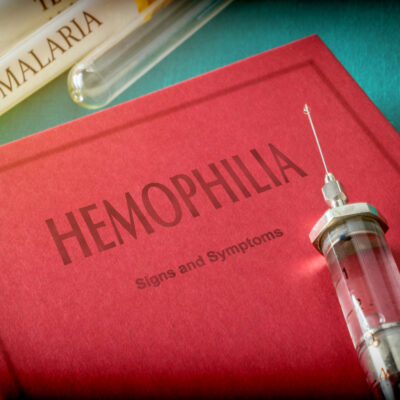 Foods That Help Manage Hemophilia Symptoms