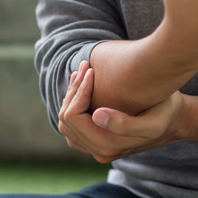 Tips to Manage Gout Symptoms Naturally