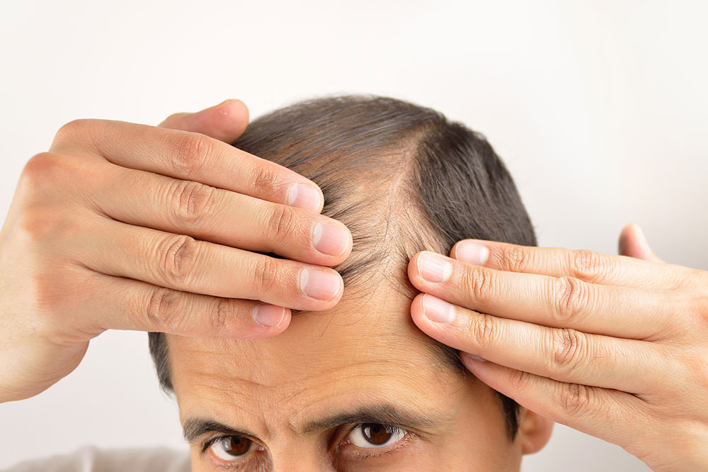 7 Lifestyle Changes That Can Reduce Hair Loss