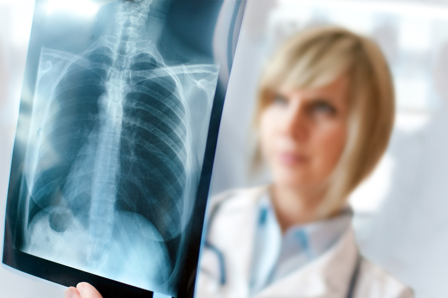5 Warning Signs of Lung Cancer: